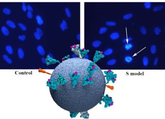 SARS-CoV-2 Spike Proteins Damages Intestinal Cells