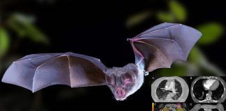 New Mysterious Fatal Pneumonia Viral Disease In Argentina