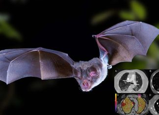 New Mysterious Fatal Pneumonia Viral Disease In Argentina