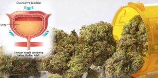 Regular Use Of Cannabis Can Lead To Increased Risk Of Overactive Bladder