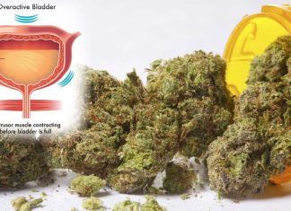 Regular Use Of Cannabis Can Lead To Increased Risk Of Overactive Bladder