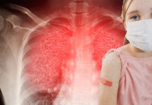 Most Children Infected With SARS-CoV-2 Have Persistent Pulmonary Dysfunction Even After Recovery