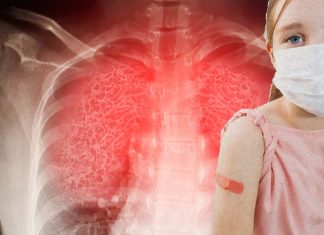 Most Children Infected With SARS-CoV-2 Have Persistent Pulmonary Dysfunction Even After Recovery