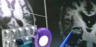 Steroids prescribed for a range of inflammatory conditions alter the structure and volume of grey and white matter in the brain