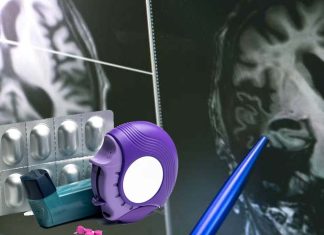 Steroids prescribed for a range of inflammatory conditions alter the structure and volume of grey and white matter in the brain