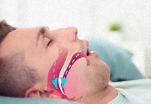 Sufferers of obstructive sleep apnea are at increased risk of developing cancer and thrombosis