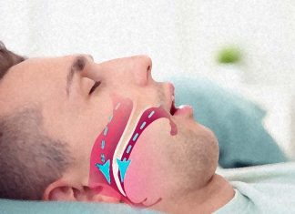 Sufferers of obstructive sleep apnea are at increased risk of developing cancer and thrombosis