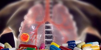 New long-term use of opioids to quell pain after lung cancer surgery is linked to a 40% heightened risk of death from any cause within the next 2 years