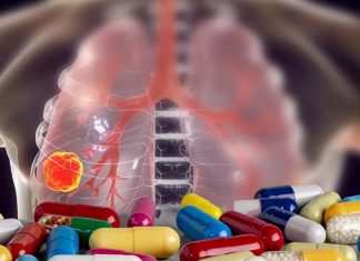New long-term use of opioids to quell pain after lung cancer surgery is linked to a 40% heightened risk of death from any cause within the next 2 years