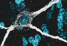SARS-CoV-2 Virus Infects The Neurons Of The Brain And Induces Neuroinflammation