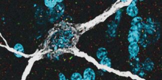 SARS-CoV-2 Virus Infects The Neurons Of The Brain And Induces Neuroinflammation
