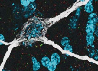 SARS-CoV-2 Virus Infects The Neurons Of The Brain And Induces Neuroinflammation
