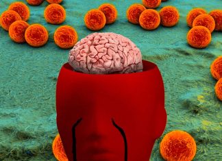 Chlamydia pneumoniae can infect the central nervous system (CNS) and contribute to the risk of Alzheimer’s disease