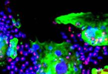 Exocyst Complex Component 2 (EXOC2) Is An Important Host Factor In SARS-CoV-2 Infections
