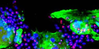 Exocyst Complex Component 2 (EXOC2) Is An Important Host Factor In SARS-CoV-2 Infections