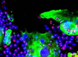 Exocyst Complex Component 2 (EXOC2) Is An Important Host Factor In SARS-CoV-2 Infections