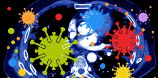 Sars-Cov-2 Infections Triggers Reduction In Circulating Monocytes That Leads To Persistent Post-COVID Pulmonary Fibrosis