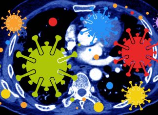 Sars-Cov-2 Infections Triggers Reduction In Circulating Monocytes That Leads To Persistent Post-COVID Pulmonary Fibrosis