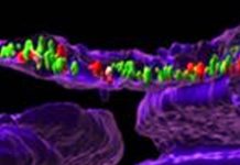 SARS-CoV-2 Spike Proteins And mRNAs Can Translocate Into The Nucleus Of Host Cells Unlike Any Other Coronaviruses