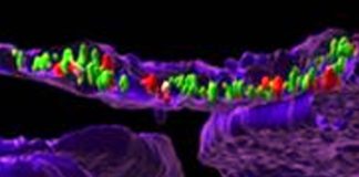 SARS-CoV-2 Spike Proteins And mRNAs Can Translocate Into The Nucleus Of Host Cells Unlike Any Other Coronaviruses