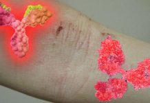 Selective IgA deficiency is an under-recognized risk factor for severe COVID-19
