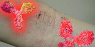 Selective IgA deficiency is an under-recognized risk factor for severe COVID-19