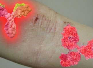 Selective IgA deficiency is an under-recognized risk factor for severe COVID-19
