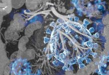 COVID-19 can cause acute abdominal pains in individuals as a result of Mesenteric Panniculitis