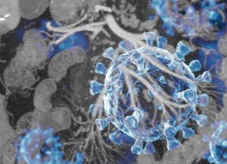 COVID-19 can cause acute abdominal pains in individuals as a result of Mesenteric Panniculitis