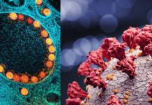 SARS-CoV-2 coronavirus is different from all other Betacoronaviruses in partially activating the IRE1α/XBP1 endoplasmic reticulum stress pathway