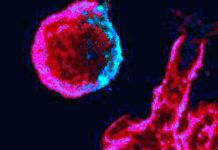 HIV Protein Nef Causes Permanent Changes To Immune Cells – Leading To Chronic Inflammation
