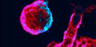 HIV Protein Nef Causes Permanent Changes To Immune Cells – Leading To Chronic Inflammation