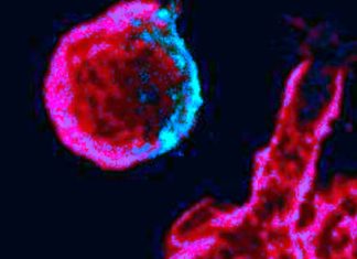 HIV Protein Nef Causes Permanent Changes To Immune Cells – Leading To Chronic Inflammation