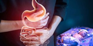 Inflammatory bowel disease is a risk factor for giving birth preterm