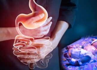 Inflammatory bowel disease is a risk factor for giving birth preterm