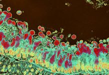 Inulin fibre promotes microbiota-derived bile acids and type 2 inflammation