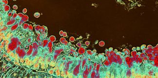 Inulin fibre promotes microbiota-derived bile acids and type 2 inflammation