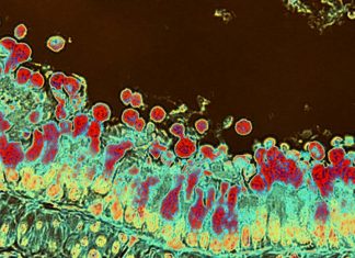 Inulin fibre promotes microbiota-derived bile acids and type 2 inflammation