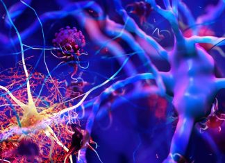 SARS-CoV-2 Spike Proteins Induces NLRP3 Inflammasome Activation In Human Microglia