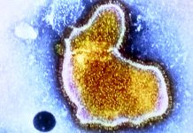 Respiratory syncytial virus (RSV) are currently rising across the globe along with Influenza and COVID-19 infections