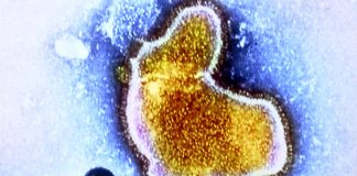 Respiratory syncytial virus (RSV) are currently rising across the globe along with Influenza and COVID-19 infections