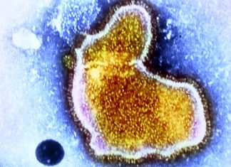 Respiratory syncytial virus (RSV) are currently rising across the globe along with Influenza and COVID-19 infections