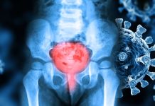 SARS-CoV-2 Infections Can Lead To Urinary Issues