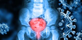 SARS-CoV-2 Infections Can Lead To Urinary Issues