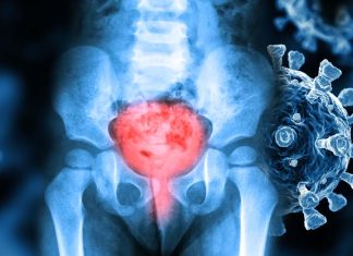 SARS-CoV-2 Infections Can Lead To Urinary Issues