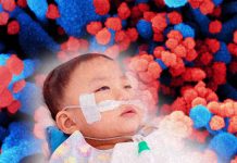 SARS-CoV-2 Is Increasing The Risk Of Strokes In Children Even In The Asymptomatic
