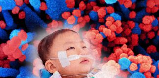 SARS-CoV-2 Is Increasing The Risk Of Strokes In Children Even In The Asymptomatic
