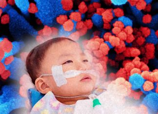 SARS-CoV-2 Is Increasing The Risk Of Strokes In Children Even In The Asymptomatic