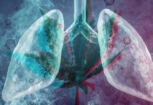 Marijuana: 75% of smokers suffer from emphysema