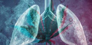 Marijuana: 75% of smokers suffer from emphysema